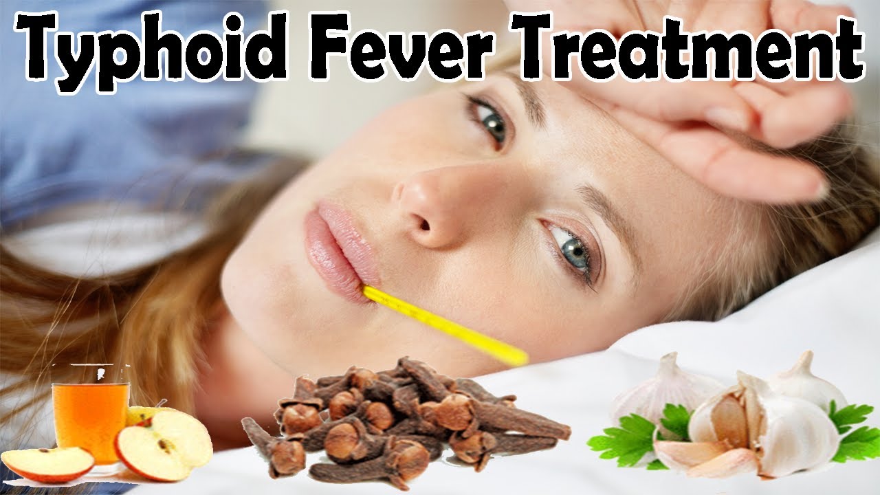 Herbal Treatments for Typhoid Fever