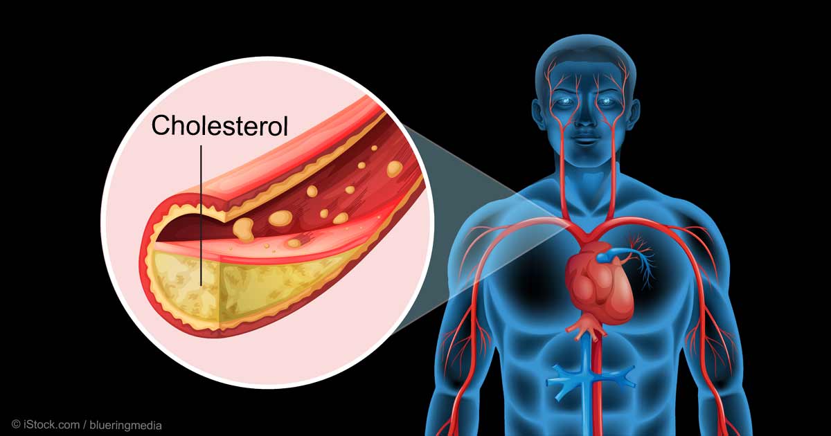 Natural Remedies for Hypercholesterolemia